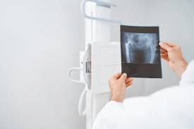 Tryout Online Simulasi Radiografer: Persiapan Optimal Menuju Kesuksesan